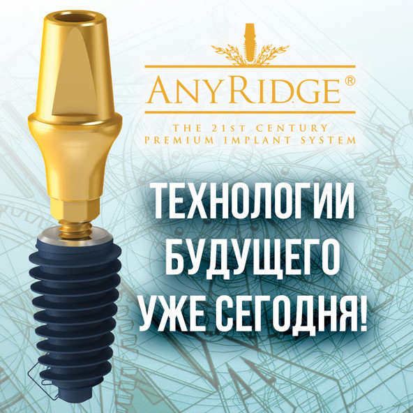 Установка имплантата "AnyRidge"